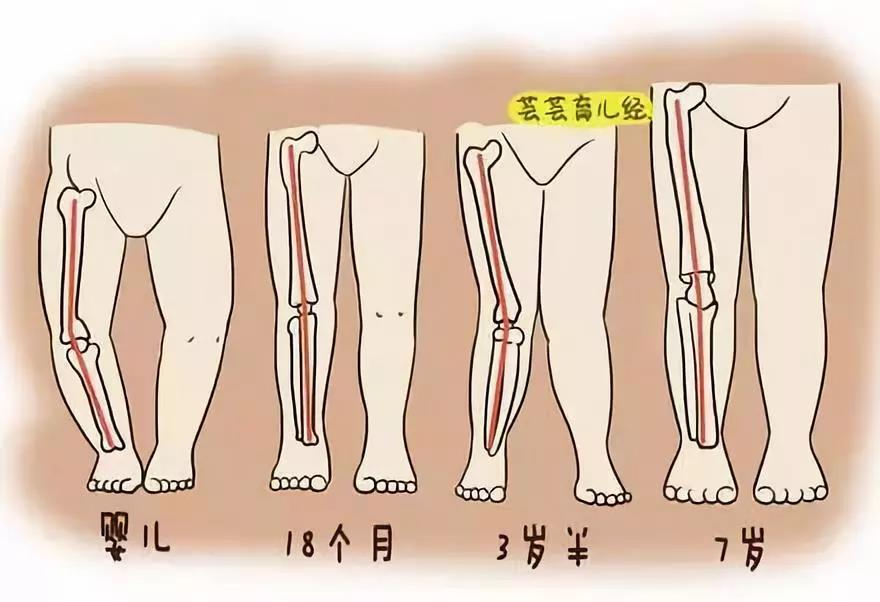 健康宝宝o型腿x型腿的小秘密一