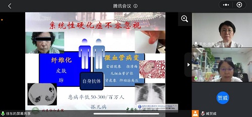 京中医医院风湿科中西合璧打硬仗 (7).jpg 京中医医院风湿科中西合璧打硬仗 (7).jpg