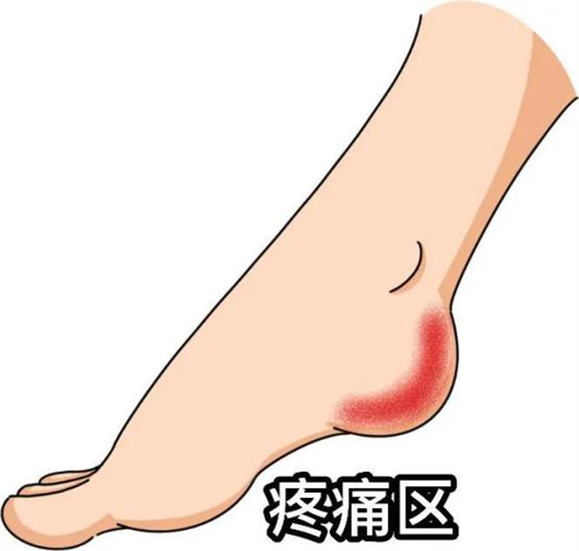 图片 2.png 图片 2.png