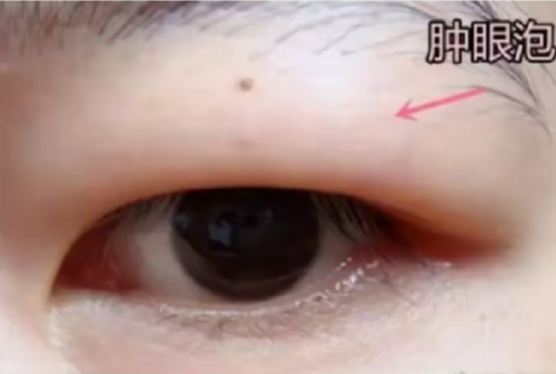 图片5.png 图片5.png
