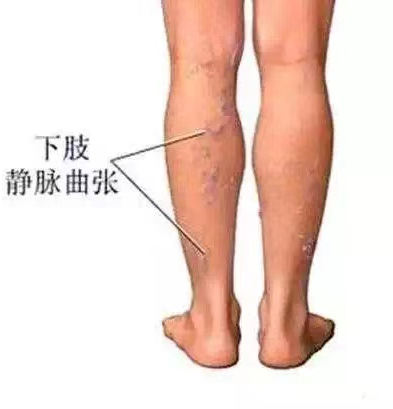 图片4.png 图片4.png